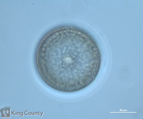 Photo of Coscinodiscus spp.